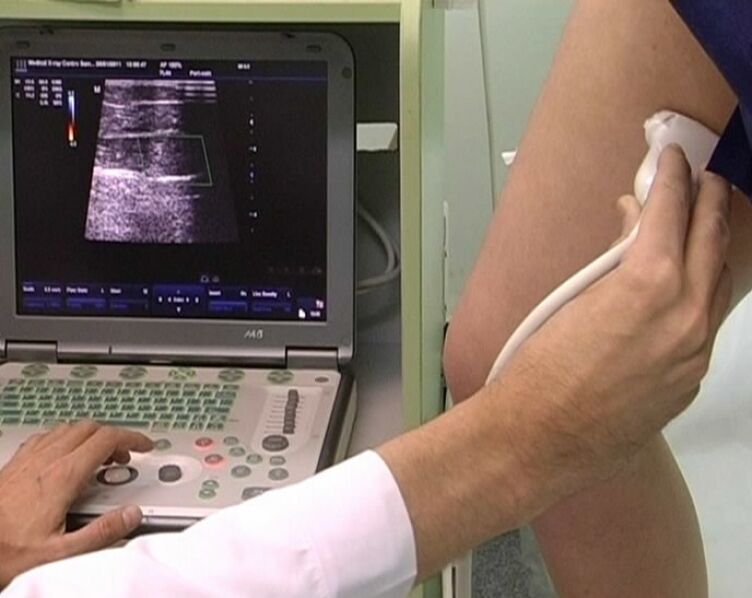 kismedencei varikózis ultrahang diagnosztikája