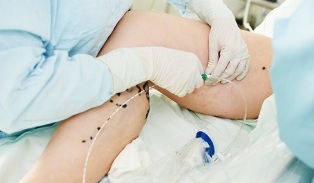 módszerek a varikózis kezelésére a lábakon nőknél